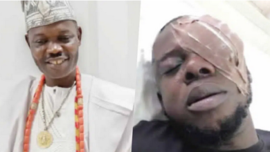 Man allegedly blinded by Ogun monarch for dancing with Queen