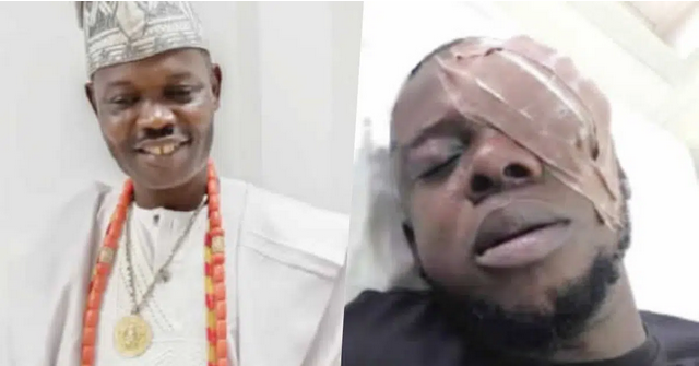Man allegedly blinded by Ogun monarch for dancing with Queen
