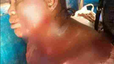 APC Women Leader Stabbed By Her Neighbor In Osun