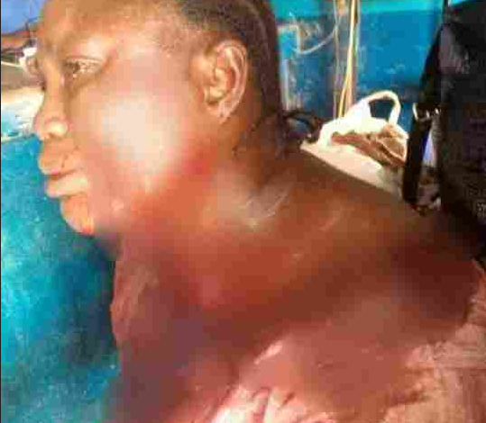 APC Women Leader Stabbed By Her Neighbor In Osun